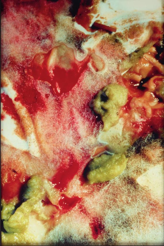 CINDY SHERMANUntitled &acute;235,...